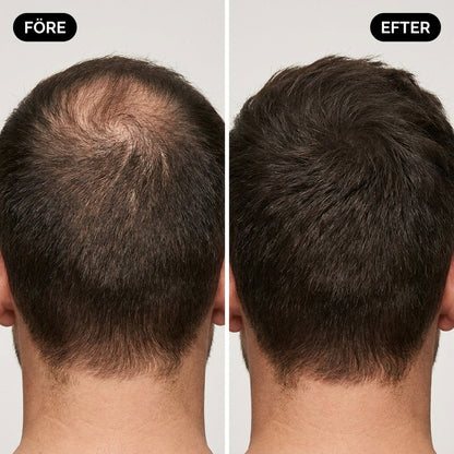 Thickr Hair filler